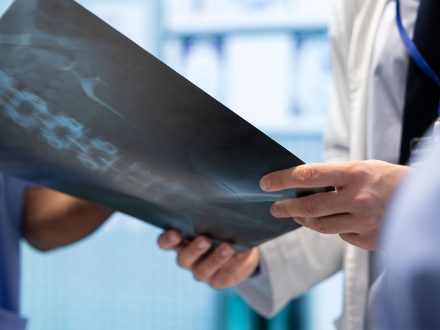 Endoskopik Omurga, Endoskopik Omurga Cerrahisi, Endoskopik omurga ameliyatı, Endoskopik bel fıtığı ameliyatı, Endoskopik boyun fıtığı ameliyatı, Endoskopik kanal daralması ameliyatı, Minimal invaziv omurga cerrahisi, Omurga cerrahisi yöntemleri, Omurga ameliyatı endoskopik teknik, Bel fıtığı endoskopik tedavi, Boyun fıtığı endoskopik tedavi, Spinal endoskopik cerrahi, Endoskopik omurga cerrahisi uzmanı, Endoskopik omurga cerrahisi doktoru, En İyi Endoskopik omurga cerrahisi uzmanı, En İyi Endoskopik omurga cerrahisi doktoru, En İyi Endoskopik cerrahi Doktoru, En İyi Endoskopik cerrahi Uzmanı