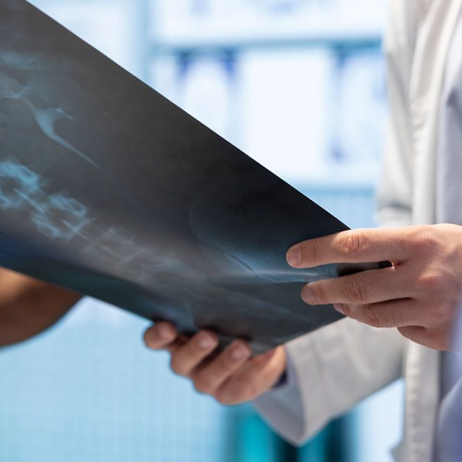 Endoskopik Omurga, Endoskopik Omurga Cerrahisi, Endoskopik omurga ameliyatı, Endoskopik bel fıtığı ameliyatı, Endoskopik boyun fıtığı ameliyatı, Endoskopik kanal daralması ameliyatı, Minimal invaziv omurga cerrahisi, Omurga cerrahisi yöntemleri, Omurga ameliyatı endoskopik teknik, Bel fıtığı endoskopik tedavi, Boyun fıtığı endoskopik tedavi, Spinal endoskopik cerrahi, Endoskopik omurga cerrahisi uzmanı, Endoskopik omurga cerrahisi doktoru, En İyi Endoskopik omurga cerrahisi uzmanı, En İyi Endoskopik omurga cerrahisi doktoru, En İyi Endoskopik cerrahi Doktoru, En İyi Endoskopik cerrahi Uzmanı