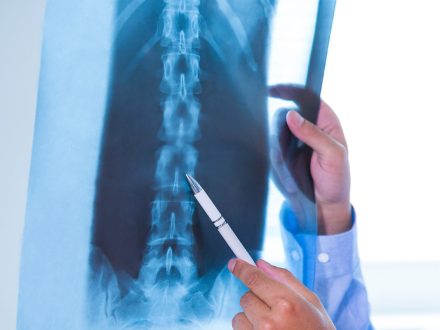 Endoskopik Omurga, Endoskopik Omurga Cerrahisi, Endoskopik omurga ameliyatı, Endoskopik bel fıtığı ameliyatı, Endoskopik boyun fıtığı ameliyatı, Endoskopik kanal daralması ameliyatı, Minimal invaziv omurga cerrahisi, Omurga cerrahisi yöntemleri, Omurga ameliyatı endoskopik teknik, Bel fıtığı endoskopik tedavi, Boyun fıtığı endoskopik tedavi, Spinal endoskopik cerrahi, Endoskopik omurga cerrahisi uzmanı, Endoskopik omurga cerrahisi doktoru, En İyi Endoskopik omurga cerrahisi uzmanı, En İyi Endoskopik omurga cerrahisi doktoru, En İyi Endoskopik cerrahi Doktoru, En İyi Endoskopik cerrahi Uzmanı