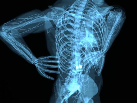 Endoskopik Omurga, Endoskopik Omurga Cerrahisi, Endoskopik omurga ameliyatı, Endoskopik bel fıtığı ameliyatı, Endoskopik boyun fıtığı ameliyatı, Endoskopik kanal daralması ameliyatı, Minimal invaziv omurga cerrahisi, Omurga cerrahisi yöntemleri, Omurga ameliyatı endoskopik teknik, Bel fıtığı endoskopik tedavi, Boyun fıtığı endoskopik tedavi, Spinal endoskopik cerrahi, Endoskopik omurga cerrahisi uzmanı, Endoskopik omurga cerrahisi doktoru, En İyi Endoskopik omurga cerrahisi uzmanı, En İyi Endoskopik omurga cerrahisi doktoru, En İyi Endoskopik cerrahi Doktoru, En İyi Endoskopik cerrahi Uzmanı