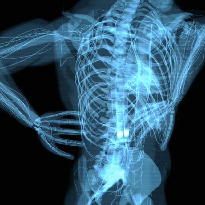 Endoskopik Omurga, Endoskopik Omurga Cerrahisi, Endoskopik omurga ameliyatı, Endoskopik bel fıtığı ameliyatı, Endoskopik boyun fıtığı ameliyatı, Endoskopik kanal daralması ameliyatı, Minimal invaziv omurga cerrahisi, Omurga cerrahisi yöntemleri, Omurga ameliyatı endoskopik teknik, Bel fıtığı endoskopik tedavi, Boyun fıtığı endoskopik tedavi, Spinal endoskopik cerrahi, Endoskopik omurga cerrahisi uzmanı, Endoskopik omurga cerrahisi doktoru, En İyi Endoskopik omurga cerrahisi uzmanı, En İyi Endoskopik omurga cerrahisi doktoru, En İyi Endoskopik cerrahi Doktoru, En İyi Endoskopik cerrahi Uzmanı