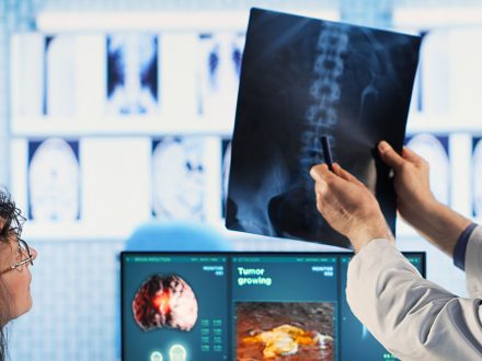 Endoskopik Omurga, Endoskopik Omurga Cerrahisi, Endoskopik omurga ameliyatı, Endoskopik bel fıtığı ameliyatı, Endoskopik boyun fıtığı ameliyatı, Endoskopik kanal daralması ameliyatı, Minimal invaziv omurga cerrahisi, Omurga cerrahisi yöntemleri, Omurga ameliyatı endoskopik teknik, Bel fıtığı endoskopik tedavi, Boyun fıtığı endoskopik tedavi, Spinal endoskopik cerrahi, Endoskopik omurga cerrahisi uzmanı, Endoskopik omurga cerrahisi doktoru, En İyi Endoskopik omurga cerrahisi uzmanı, En İyi Endoskopik omurga cerrahisi doktoru, En İyi Endoskopik cerrahi Doktoru, En İyi Endoskopik cerrahi Uzmanı