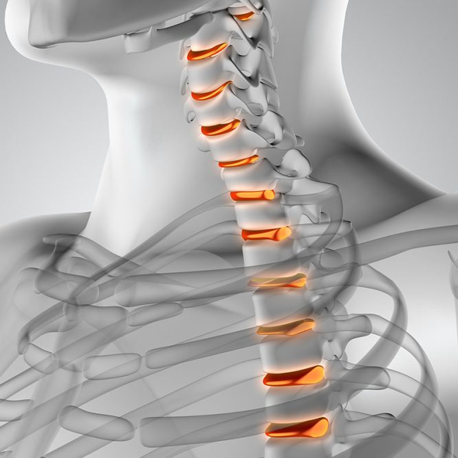 Endoskopik Omurga, Endoskopik Omurga Cerrahisi, Endoskopik omurga ameliyatı, Endoskopik bel fıtığı ameliyatı, Endoskopik boyun fıtığı ameliyatı, Endoskopik kanal daralması ameliyatı, Minimal invaziv omurga cerrahisi, Omurga cerrahisi yöntemleri, Omurga ameliyatı endoskopik teknik, Bel fıtığı endoskopik tedavi, Boyun fıtığı endoskopik tedavi, Spinal endoskopik cerrahi, Endoskopik omurga cerrahisi uzmanı, Endoskopik omurga cerrahisi doktoru, En İyi Endoskopik omurga cerrahisi uzmanı, En İyi Endoskopik omurga cerrahisi doktoru, En İyi Endoskopik cerrahi Doktoru, En İyi Endoskopik cerrahi Uzmanı