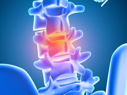 Endoskopik Omurga, Endoskopik Omurga Cerrahisi, Endoskopik omurga ameliyatı, Endoskopik bel fıtığı ameliyatı, Endoskopik boyun fıtığı ameliyatı, Endoskopik kanal daralması ameliyatı, Minimal invaziv omurga cerrahisi, Omurga cerrahisi yöntemleri, Omurga ameliyatı endoskopik teknik, Bel fıtığı endoskopik tedavi, Boyun fıtığı endoskopik tedavi, Spinal endoskopik cerrahi, Endoskopik omurga cerrahisi uzmanı, Endoskopik omurga cerrahisi doktoru, En İyi Endoskopik omurga cerrahisi uzmanı, En İyi Endoskopik omurga cerrahisi doktoru, En İyi Endoskopik cerrahi Doktoru, En İyi Endoskopik cerrahi Uzmanı