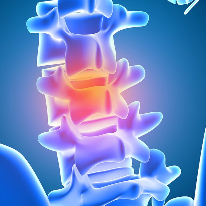 Endoskopik Omurga, Endoskopik Omurga Cerrahisi, Endoskopik omurga ameliyatı, Endoskopik bel fıtığı ameliyatı, Endoskopik boyun fıtığı ameliyatı, Endoskopik kanal daralması ameliyatı, Minimal invaziv omurga cerrahisi, Omurga cerrahisi yöntemleri, Omurga ameliyatı endoskopik teknik, Bel fıtığı endoskopik tedavi, Boyun fıtığı endoskopik tedavi, Spinal endoskopik cerrahi, Endoskopik omurga cerrahisi uzmanı, Endoskopik omurga cerrahisi doktoru, En İyi Endoskopik omurga cerrahisi uzmanı, En İyi Endoskopik omurga cerrahisi doktoru, En İyi Endoskopik cerrahi Doktoru, En İyi Endoskopik cerrahi Uzmanı